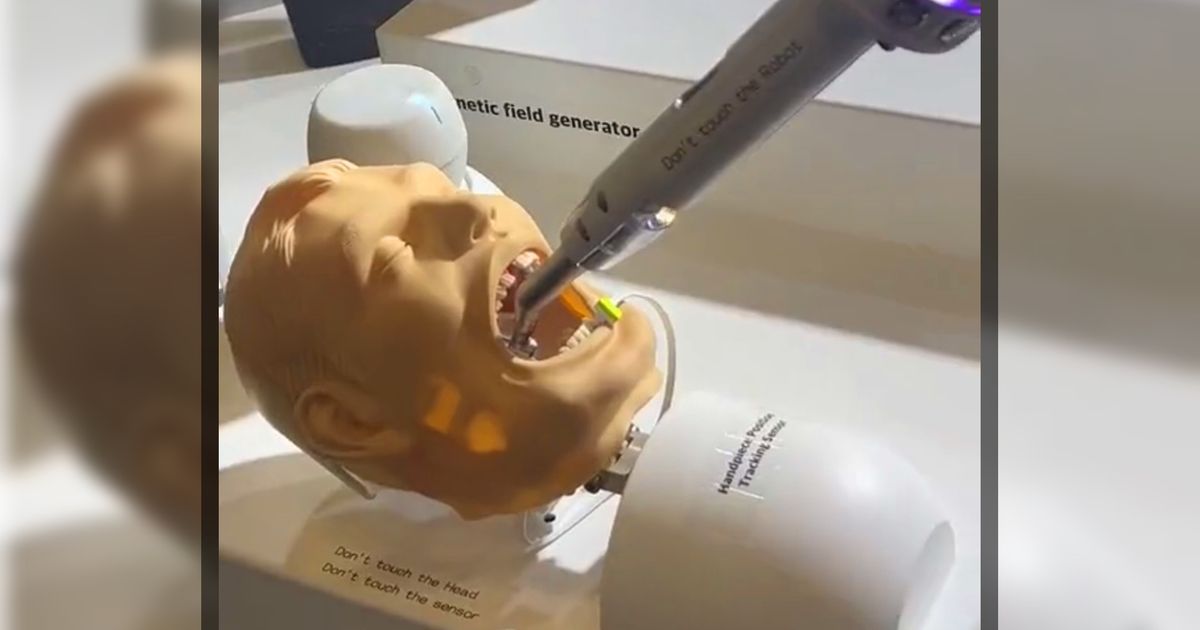 An image of a terrifying AI dentist robot performing inside a male mouth 