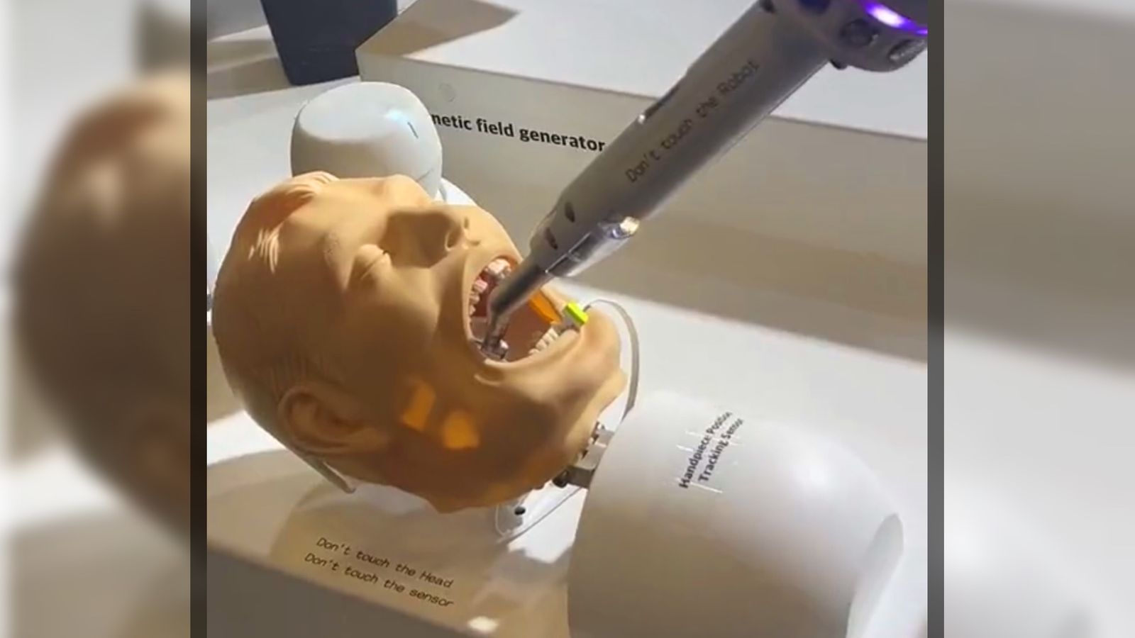 An image of a terrifying AI dentist robot performing inside a male mouth 